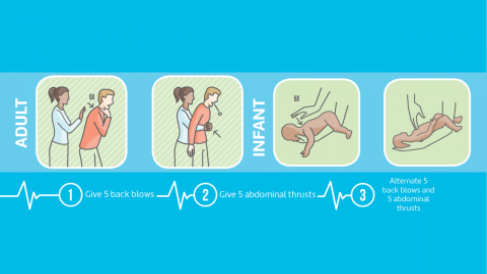 Heimlich Maneuver Instructions